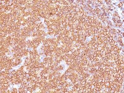 CD20 Antibody (SPM618) - Azide and BSA Free Immunohistochemistry-Paraffin: CD20 Antibody (SPM618) - Azide and BSA Free [NBP3-11495] -