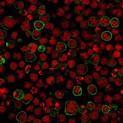 CD20 Antibody (SPM618) - Azide and BSA Free Immunocytochemistry/ Immunofluorescence: CD20 Antibody (SPM618) - Azide and BSA Free [NBP3-11495] -