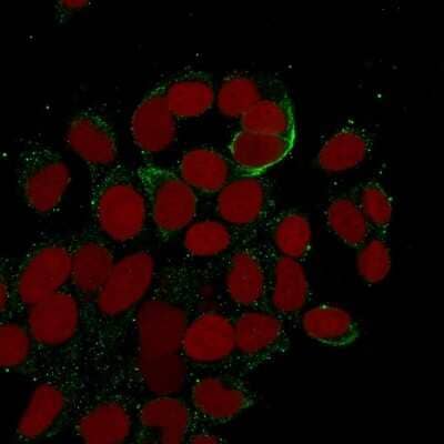 Cytokeratin 10/13 Antibody (DE-K13) - Azide and BSA Free Immunocytochemistry/ Immunofluorescence: Cytokeratin 10/13 Antibody (DE-K13) - Azide and BSA Free [NBP3-11497] -