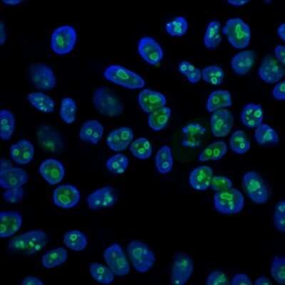 Nucleolin Antibody (SPM614) - Azide and BSA Free Immunocytochemistry/ Immunofluorescence: Nucleolin Antibody (SPM614) - Azide and BSA Free [NBP3-11498] -