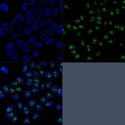 Nucleolin Antibody (SPM614) - Azide and BSA Free Immunocytochemistry/ Immunofluorescence: Nucleolin Antibody (SPM614) - Azide and BSA Free [NBP3-11498] -