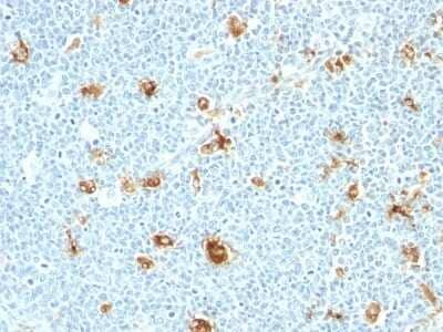 S100A9 Antibody (CAGB/426) - Azide and BSA Free Immunohistochemistry-Paraffin: S100A9 Antibody (CAGB/426) - Azide and BSA Free [NBP3-11506] -