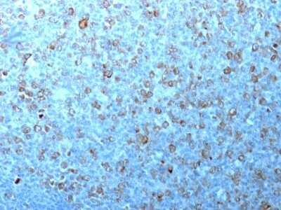 CDC2/CDK1 Antibody (CDK1/873) - Azide and BSA Free Immunohistochemistry-Paraffin: CDC2/CDK1 Antibody (CDK1/873) - Azide and BSA Free [NBP3-11507] -