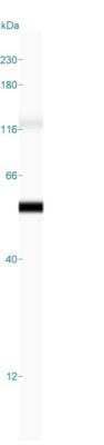 Cytokeratin 18 Antibody (DE-K18) - Azide and BSA Free Simple Western: Cytokeratin 18 Antibody (DE-K18) - Azide and BSA Free [NBP3-11516] -