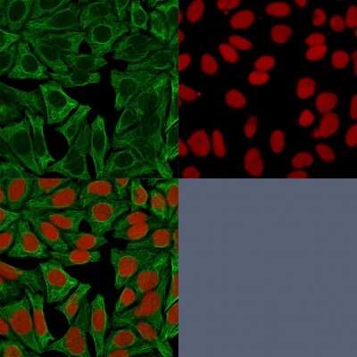Cytokeratin 18 Antibody (DE-K18) - Azide and BSA Free Immunocytochemistry/ Immunofluorescence: Cytokeratin 18 Antibody (DE-K18) - Azide and BSA Free [NBP3-11516] -