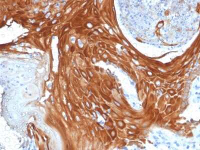 Cytokeratin 6a Antibody (KRT6A/2368) - Azide and BSA Free Immunohistochemistry-Paraffin: Cytokeratin 6a Antibody (KRT6A/2368) - Azide and BSA Free [NBP3-11521] -