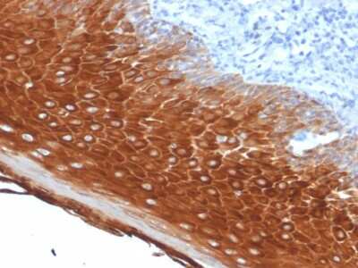 Cytokeratin 6a Antibody (KRT6A/2368) - Azide and BSA Free Immunohistochemistry-Paraffin: Cytokeratin 6a Antibody (KRT6A/2368) - Azide and BSA Free [NBP3-11521] -