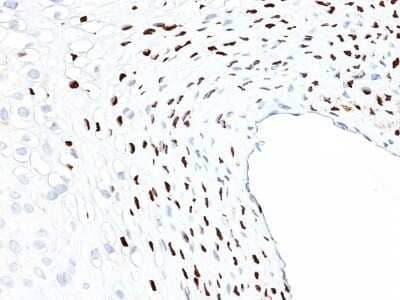 HPV16 Antibody (HPV16L1/1058) - Azide and BSA Free Immunohistochemistry-Paraffin: HPV16 Antibody (HPV16L1/1058) - Azide and BSA Free [NBP3-11542] -