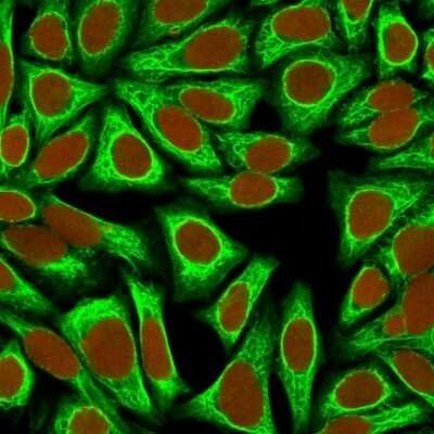 Cytokeratin 18 Antibody (KRT18/836) - Azide and BSA Free Immunocytochemistry/ Immunofluorescence: Cytokeratin 18 Antibody (KRT18/836) - Azide and BSA Free [NBP3-11544] -