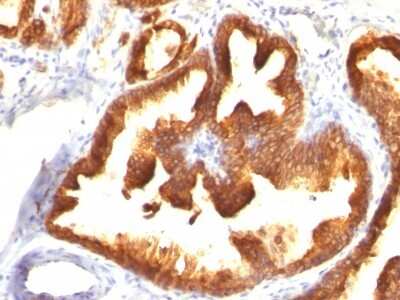 Cytokeratin 18 Antibody (KRT18/836) - Azide and BSA Free Immunohistochemistry-Paraffin: Cytokeratin 18 Antibody (KRT18/836) - Azide and BSA Free [NBP3-11544] -