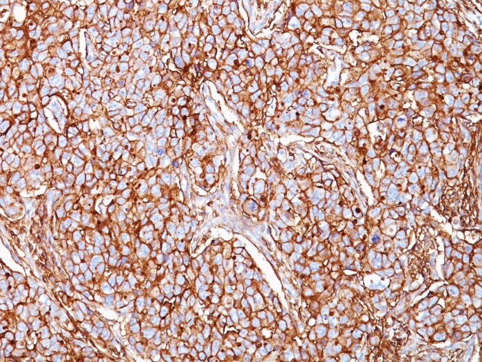 CD44 Antibody (SPM521) - Azide and BSA Free Immunohistochemistry-Paraffin: CD44 Antibody (SPM521) - Azide and BSA Free [NBP3-11550] -