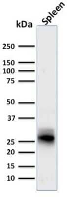 HLA DRB1 Antibody (SPM423) - Azide and BSA Free Western Blot: HLA DRB1 Antibody (SPM423) - Azide and BSA Free [NBP3-11552] -