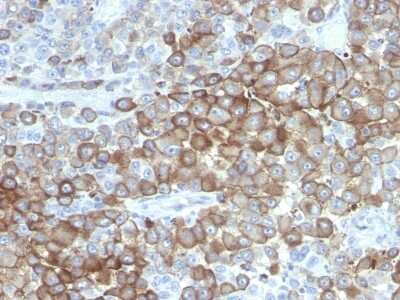 Melanoma Associated Antigen (PNL2) Antibody (PNL2) - Azide and BSA Free Immunohistochemistry-Paraffin: Melanoma Associated Antigen (PNL2) Antibody (PNL2) - Azide and BSA Free [NBP3-11561] -
