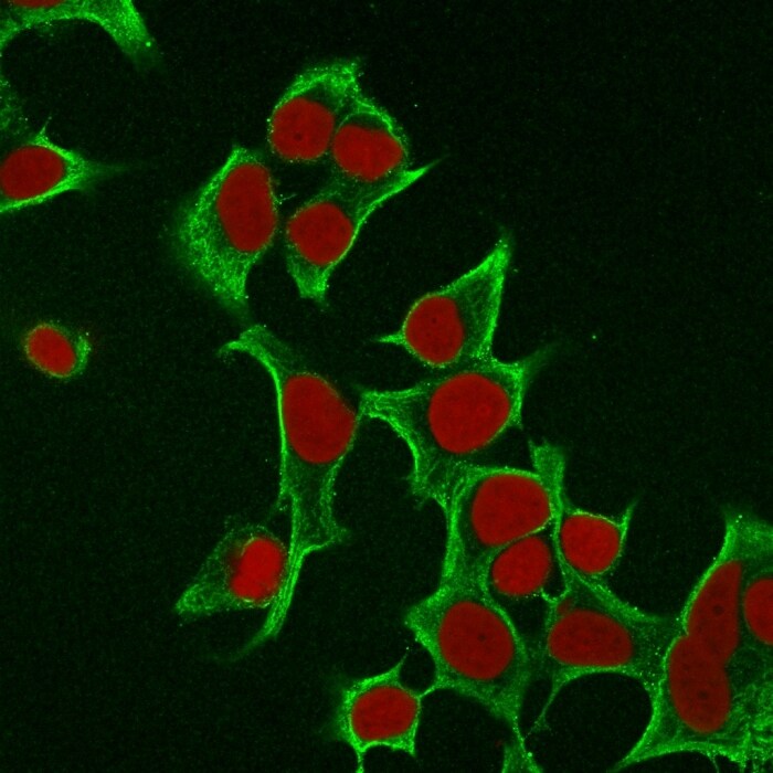 Cytokeratin 8 Antibody (B22.1) - Azide and BSA Free Immunocytochemistry/ Immunofluorescence: Cytokeratin 8 Antibody (B22.1) - Azide and BSA Free [NBP3-11566] -