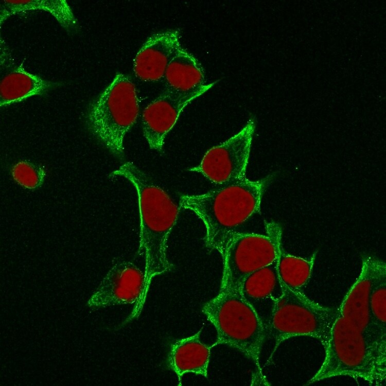 Cytokeratin 8 Antibody (B22.1) - Azide and BSA Free Immunocytochemistry/ Immunofluorescence: Cytokeratin 8 Antibody (B22.1) - Azide and BSA Free [NBP3-11566] -