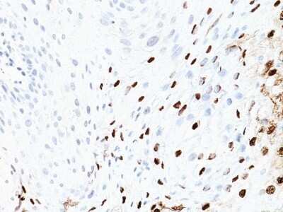 HPV16 Antibody (SPM405) - Azide and BSA Free Immunohistochemistry-Paraffin: HPV16 Antibody (SPM405) - Azide and BSA Free [NBP3-11575] -