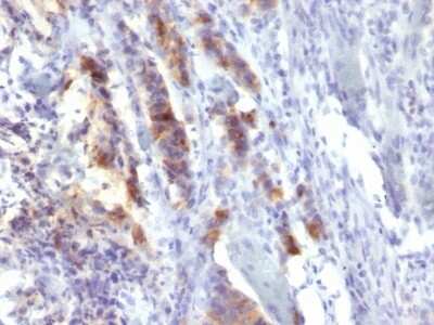 MUC5AC Antibody (SPM488) - Azide and BSA Free Immunohistochemistry-Paraffin: MUC5AC Antibody (SPM488) - Azide and BSA Free [NBP3-11583] -