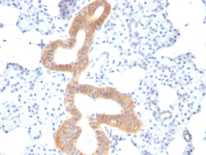 B7-2/CD86 Antibody (SPM600) - Azide and BSA Free Immunohistochemistry-Paraffin: B7-2/CD86 Antibody (SPM600) - Azide and BSA Free [NBP3-11584] -