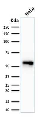 Cytokeratin 7 Antibody (SPM270) - Azide and BSA Free Western Blot: Cytokeratin 7 Antibody (SPM270) - Azide and BSA Free [NBP3-11594] -
