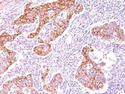 Phospho-Tyrosine Antibody (SPM102) - Azide and BSA Free Immunohistochemistry-Paraffin: Phospho-Tyrosine Antibody (SPM102) - Azide and BSA Free [NBP3-11616] -