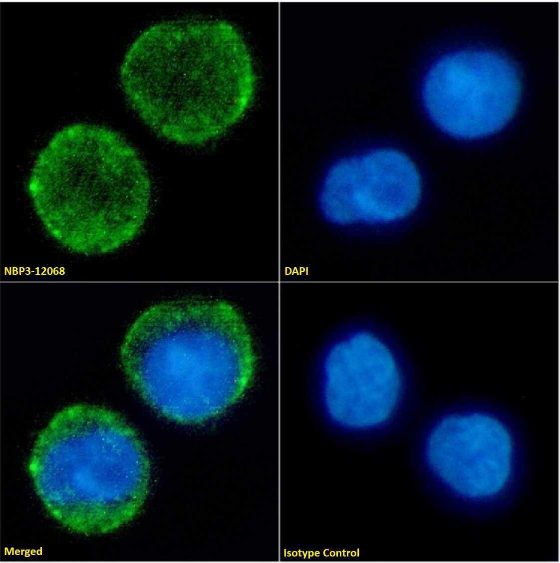 Neprilysin/CD10 Antibody (FR4D11) - Chimeric - Azide and BSA Free