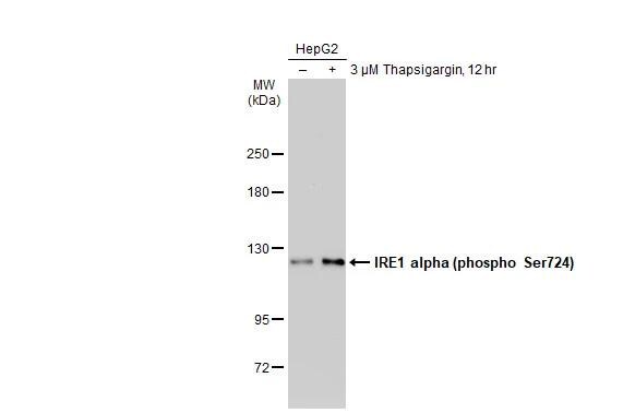 IRE1 alpha [p Ser724] Antibody