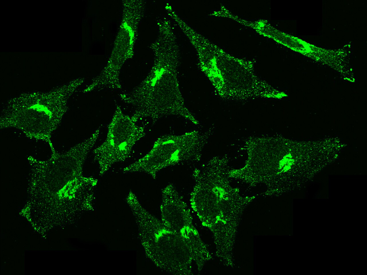 GOLM1 Antibody (12) - Azide and BSA Free