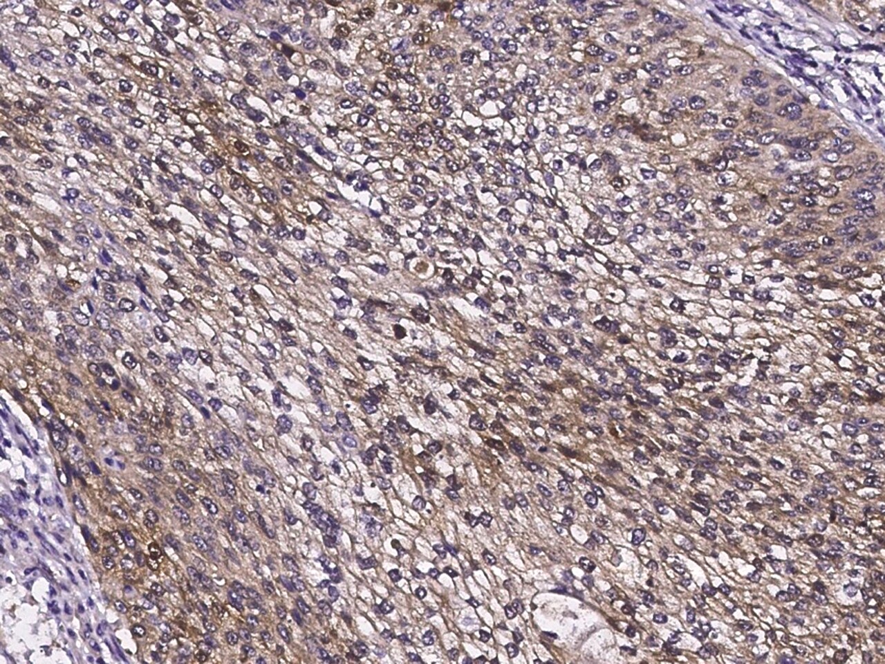 gamma-Glutamylcyclotransferase/CRF21/GGCT Antibody - Azide and BSA Free