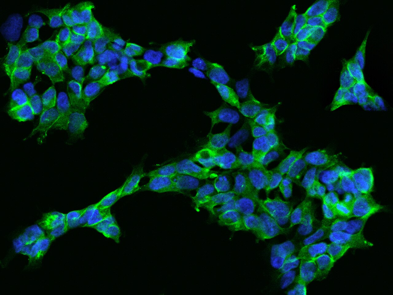 gamma Adducin Antibody - BSA Free