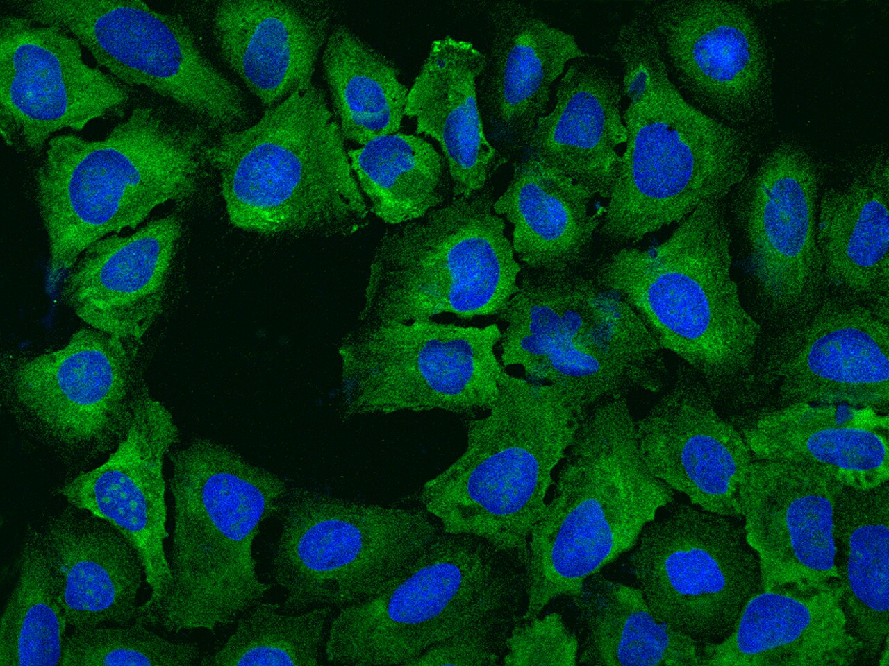 RPS14 Antibody - BSA Free