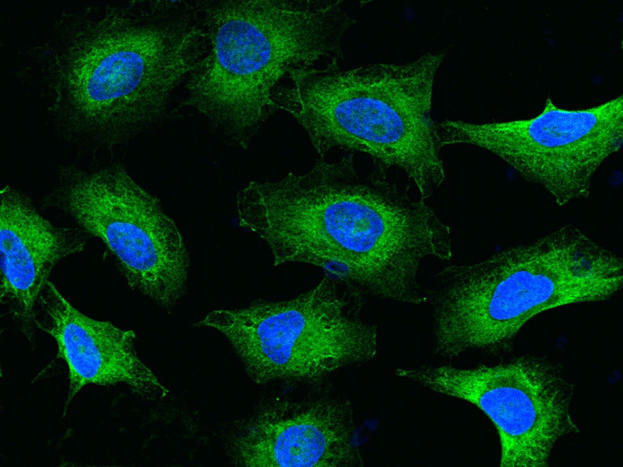 RPS17 Antibody - BSA Free