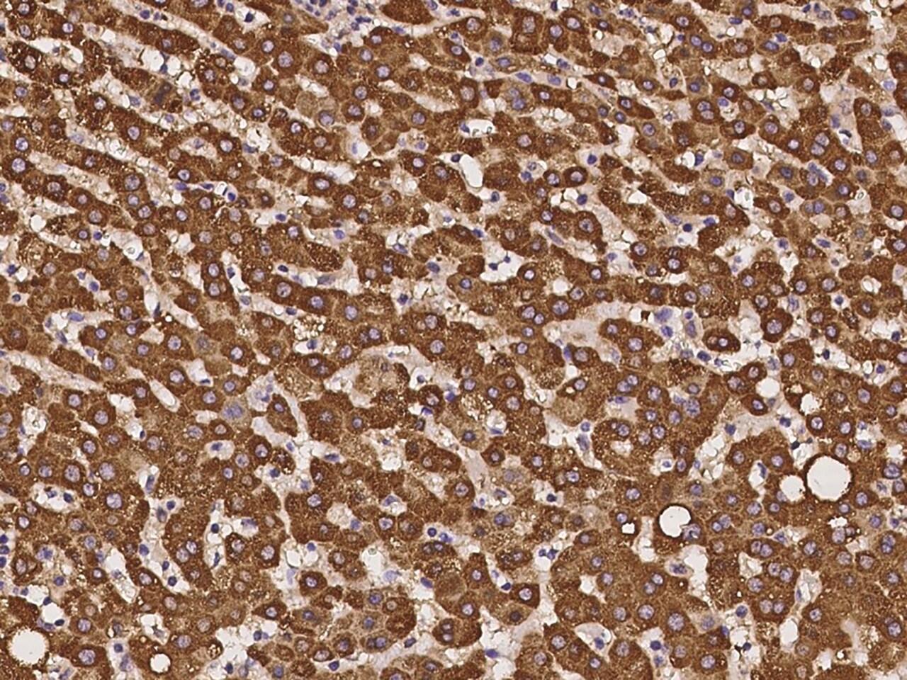 BEND3 Antibody - BSA Free