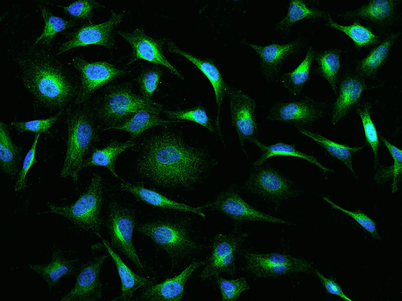 GLYCTK Antibody - BSA Free