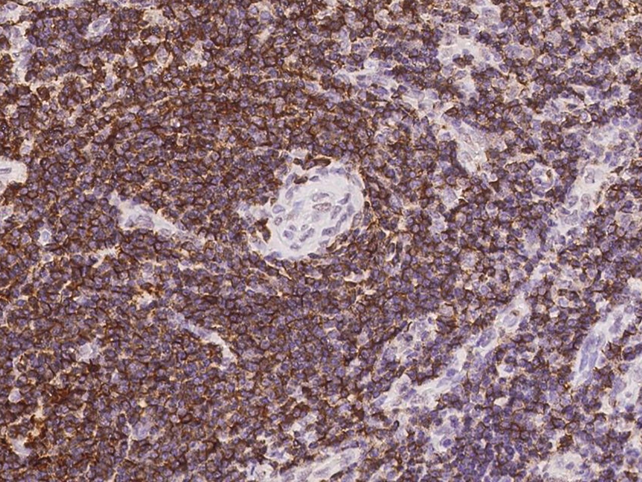 PTPRCAP Antibody - BSA Free