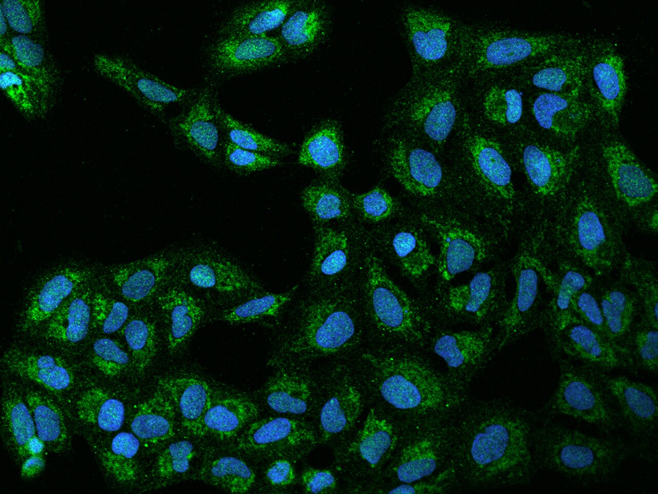 TIMM29 Antibody - BSA Free