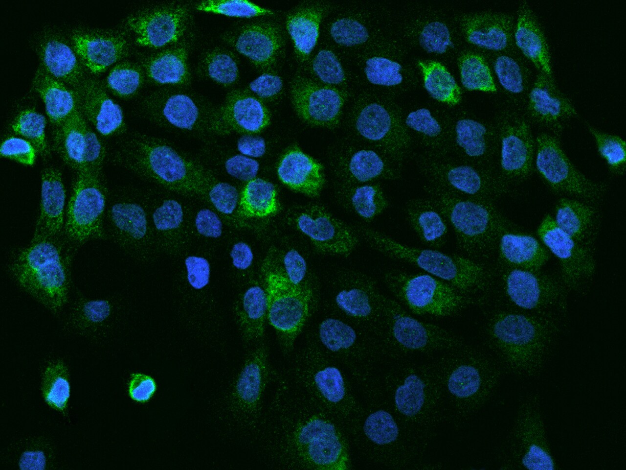 CC2D1A Antibody - BSA Free
