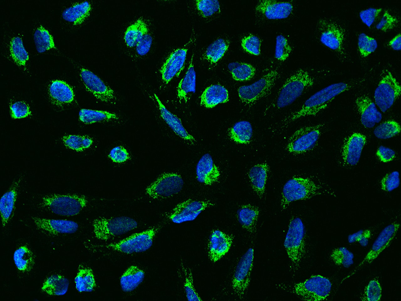 Mitochondrial ribonuclease P protein 3 Antibody - BSA Free