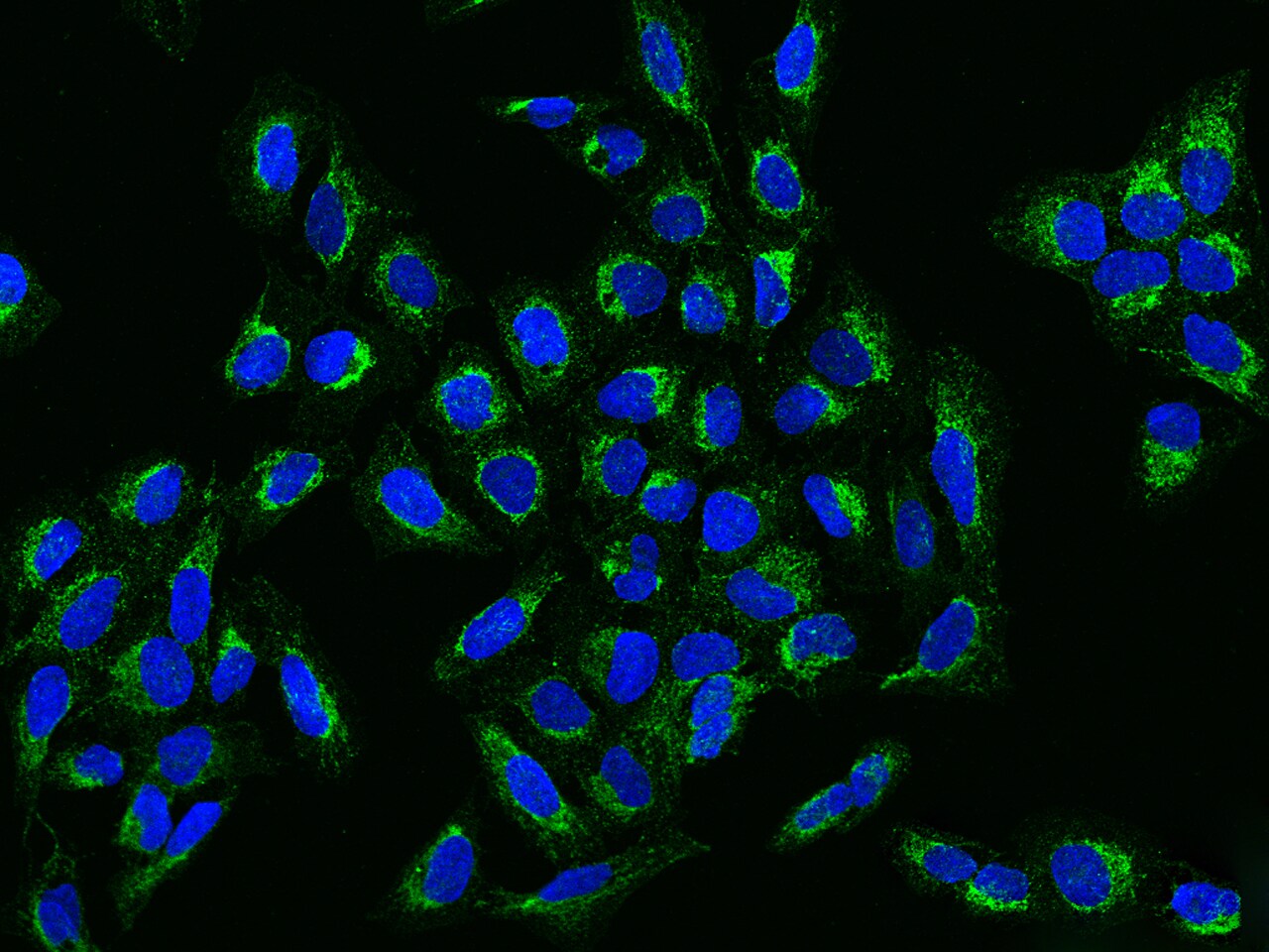 Ccd1/DIXDC1 Antibody - BSA Free