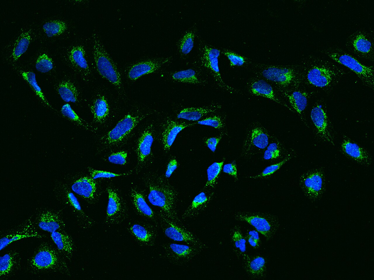 SLC37A3 Antibody - BSA Free