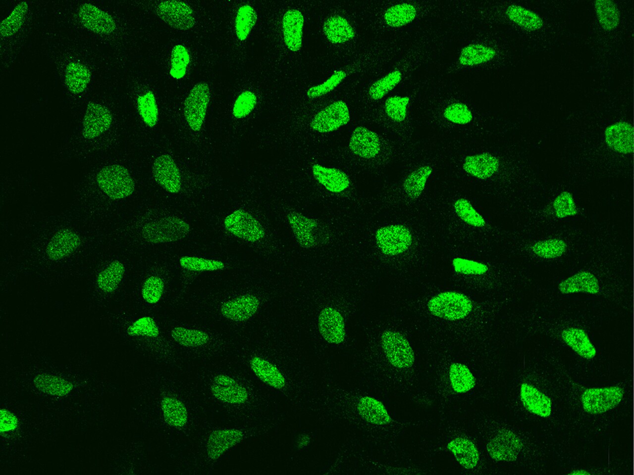 ARID2 Antibody - BSA Free