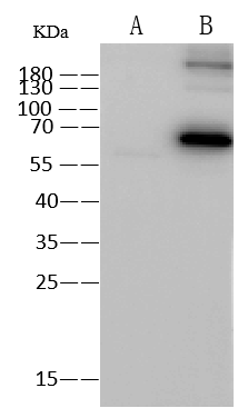 Influenza B nucleoprotein Antibody (016) Western Blot: Influenza B nucleoprotein Antibody (016) [NBP3-12755]