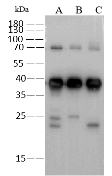 EBOV VP40 protein Antibody (02)