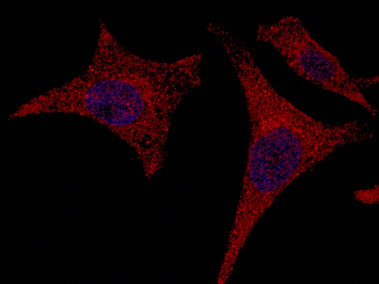 Alanyl tRNA synthetase Antibody - Azide and BSA Free
