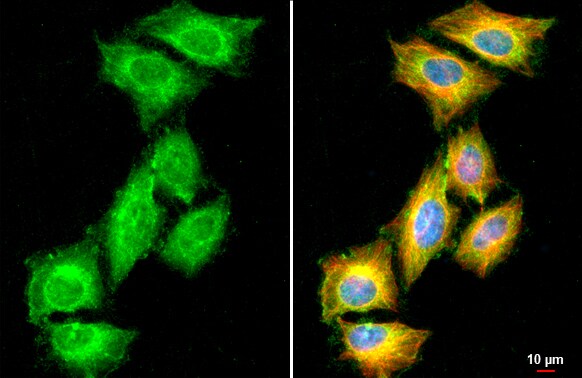 Chordin-like 1/CHRDL1 Antibody