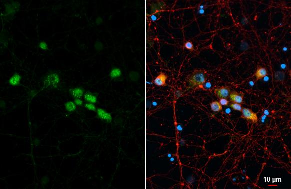 LIM1 Antibody