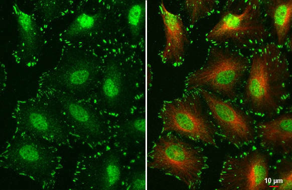FAK [p Tyr397] Antibody