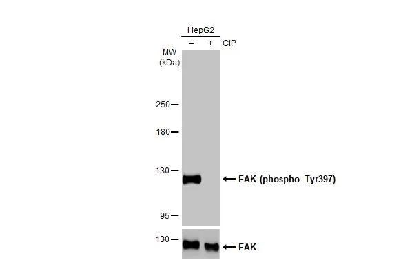 FAK [p Tyr397] Antibody