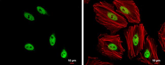 SOX8 Antibody - BSA Free