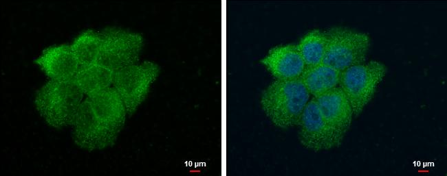 VPS18 Antibody - BSA Free