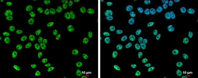 SETD1A Antibody - BSA Free
